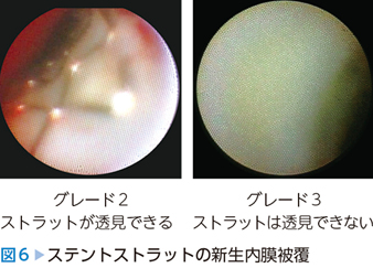 裁断済み　「血管内イメージングパーフェクトガイド」 血管内イメージングパーフェクトガイド 【動画を含む電子版付